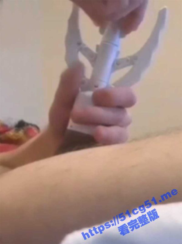 自己动手割包皮 外国人胆真大啊 这工具怎么看着像开瓶器啊 这么自己在家割真的安全么-51吃瓜网
