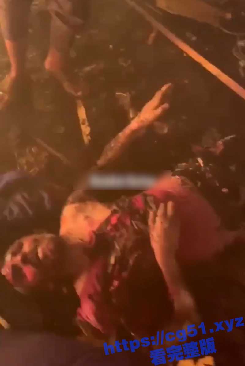 以色列大屠杀现场 加沙拉法地区遭以军轰炸 大量难民被炸死 还有儿童被炸到人首分离 这才是人间撒旦啊 - 51吃瓜网-51吃瓜网