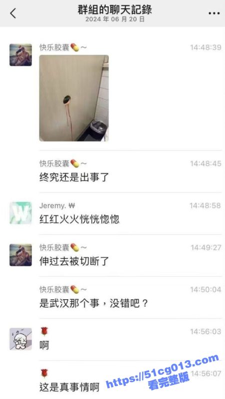 疼疼疼！看着都疼！鸟洞的故事 男同们的恶趣味 这下我看谁还敢乱伸！-51吃瓜网