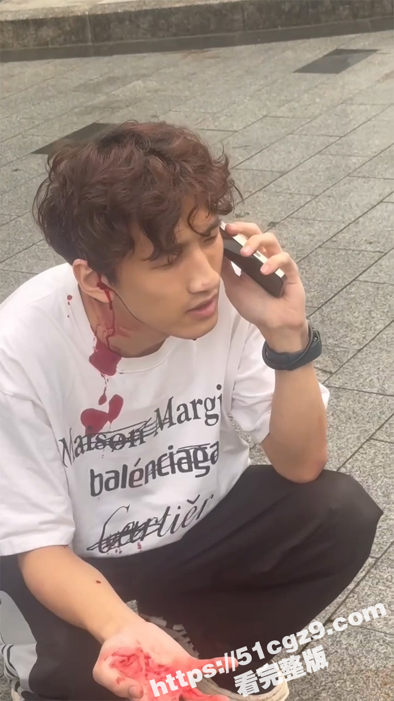 杭州网络乞丐男模江江 恶心狗皮膏药男 给大姐推荐男模没相中 一个月后索要发单费 被大姐找人爆头开瓢 - 51吃瓜网-51吃瓜网